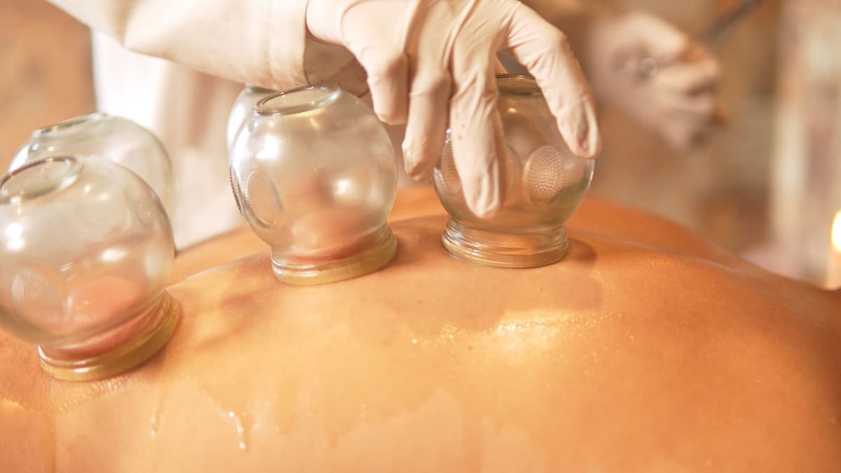 Cupping Therapy