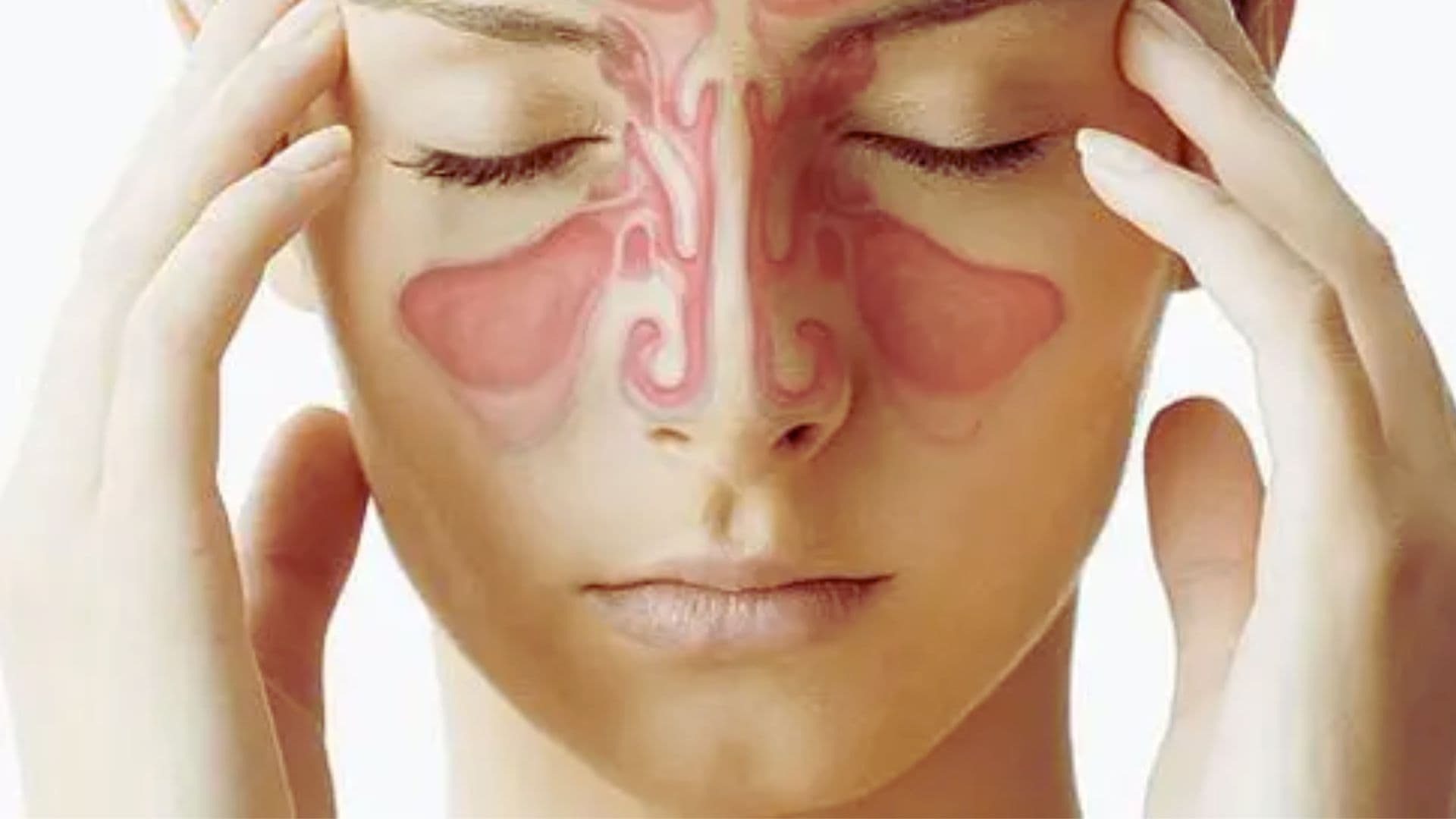 Sinusitis