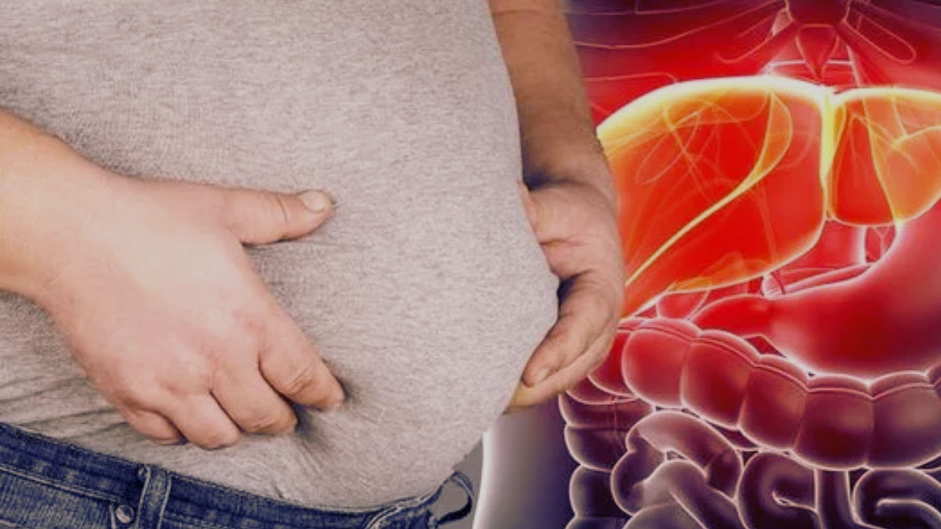 Fatty liver