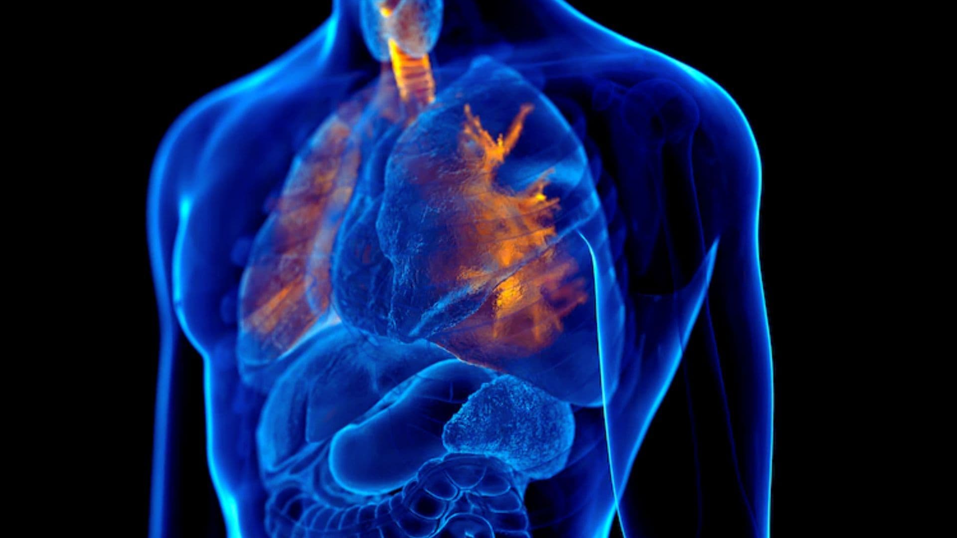 Bronchial Asthma