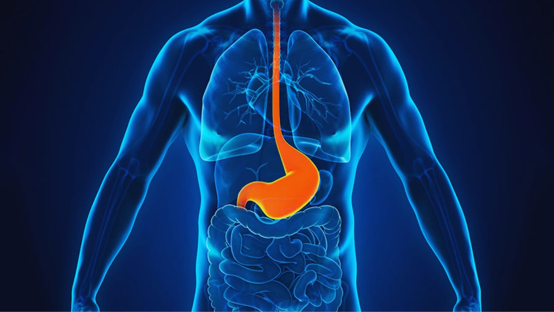 Gastroesophageal Reflux Disease (GERD)